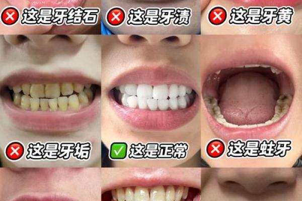 男人梦到全口牙掉光了 男人梦到全口牙掉光了